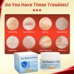 Fast Scar Removal Cream