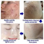Salicylic Acid Pore Shrinking Cream – Tightens Face, Smooths Skin, and Eliminates Blackheads & Large Pores.