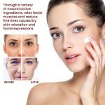 "Rice Anti-Wrinkle Cream – Acne, Melasma & Pigmentation Treatment, Whitening & Lifting Moisturizer. 30g Korean Beauty!"