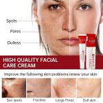 Whitening Freckle Cream – Melasma, Dark Spot & Pigmentation Removal for Brighter, Even Skin.