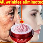 "Dragon Blood Cream – Wrinkle Removal, Firming, Anti-Aging, Whitening & Pore-Reducing Facial Serum!"