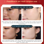 "Dragon Blood Cream – Wrinkle Removal, Firming, Anti-Aging, Whitening & Pore-Reducing Facial Serum!"