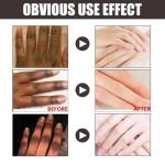 Dark Knuckles Whitening Serum – Fast Stain Removal for Hands, Elbows & Knees, Intense Melanin Corrector for Smooth, Even Skin!"