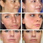 Dark Spot Remover Serum: Brightens, corrects pigmentation, and fades freckles. Day & night use.