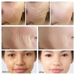 "Retinol Anti-Aging Face Set – Instant Firming, Wrinkle Removal, Fine Line Fading & Whitening. Korean Skincare!"