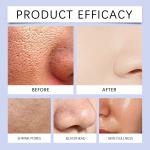 Blue Microneedle Serum - Shrinks pores, whitens, lifts, firms, and hydrates skin while reducing fine lines and melanin.