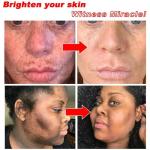 Dark Spot Remover Serum: Brightens, corrects pigmentation, and fades freckles. Day & night use.