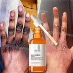 Dark Knuckles Whitening Serum – Fast Stain Removal for Hands, Elbows & Knees, Intense Melanin Corrector for Smooth, Even Skin!"