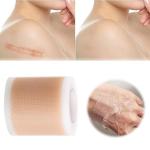 Silicone Gel Scar Patch: Effective treatment for scars, burns, acne, and trauma. Promotes skin repair and healing.