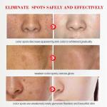 Whitening Freckle Cream – Melasma, Dark Spot & Pigmentation Removal for Brighter, Even Skin.