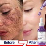 Dark Spot Remover Serum: Brightens, corrects pigmentation, and fades freckles. Day & night use.