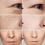"Retinol Anti-Aging Face Set – Instant Firming, Wrinkle Removal, Fine Line Fading & Whitening. Korean Skincare!"