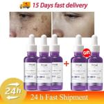 Dark Spot Remover Serum: Brightens, corrects pigmentation, and fades freckles. Day & night use.