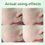 Salicylic Acid Cream - Reduces blackheads, tightens skin, and shrinks pores.