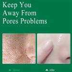 Salicylic Acid Pore Shrinking Cream – Tightens Face, Smooths Skin, and Eliminates Blackheads & Large Pores.