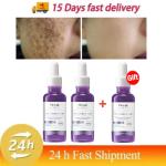 Dark Spot Remover Serum: Brightens, corrects pigmentation, and fades freckles. Day & night use.