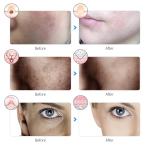 "Rechargeable 7-Color LED Facial Mask – Skin Rejuvenation, Face Lifting & Whitening!"