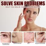 "Rice Anti-Wrinkle Cream – Acne, Melasma & Pigmentation Treatment, Whitening & Lifting Moisturizer. 30g Korean Beauty!"