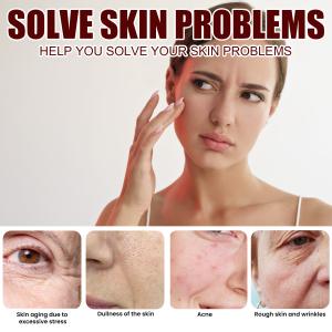 "Rice Anti-Wrinkle Cream – Acne, Melasma & Pigmentation Treatment, Whitening & Lifting Moisturizer. 30g Korean Beauty!"