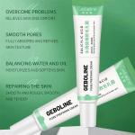 Salicylic Acid Cream - Reduces blackheads, tightens skin, and shrinks pores.