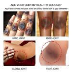 Dark Knuckles Whitening Serum – Fast Stain Removal for Hands, Elbows & Knees, Intense Melanin Corrector for Smooth, Even Skin!"
