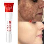 Whitening Freckle Cream – Melasma, Dark Spot & Pigmentation Removal for Brighter, Even Skin.