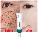 Salicylic Acid Pore Shrinking Cream – Tightens Face, Smooths Skin, and Eliminates Blackheads & Large Pores.