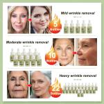 Anti-Wrinkle Essence – Lift, Tighten & Moisturize, Reduces Fine Lines.