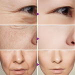 "Dragon Blood Cream – Wrinkle Removal, Firming, Anti-Aging, Whitening & Pore-Reducing Facial Serum!"