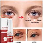 "Retinol Anti-Aging Face Set – Instant Firming, Wrinkle Removal, Fine Line Fading & Whitening. Korean Skincare!"