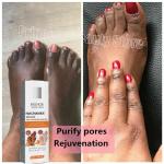 Dark Knuckles Whitening Serum – Fast Stain Removal for Hands, Elbows & Knees, Intense Melanin Corrector for Smooth, Even Skin!"