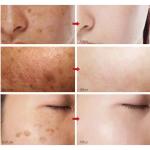 "White Rice Moisturizing Cream – Fades Dark Spots, Freckles & Melanin, Reduces Wrinkles, and Promotes Youthful Skin!"