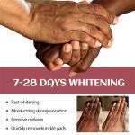 Dark Knuckles Whitening Serum – Fast Stain Removal for Hands, Elbows & Knees, Intense Melanin Corrector for Smooth, Even Skin!"