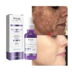 Dark Spot Remover Serum: Brightens, corrects pigmentation, and fades freckles. Day & night use.